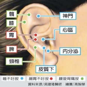 Ear Needles for Weight Loss